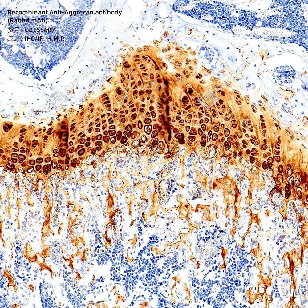 Recombinant Anti-Aggrecan antibody (Rabbit mAb) - 100 µL