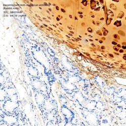 Recombinant Anti-Aggrecan antibody (Rabbit mAb) - 100 µL