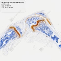 Recombinant Anti-Aggrecan antibody (Rabbit mAb) - 100 µL