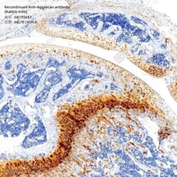 Recombinant Anti-Aggrecan antibody (Rabbit mAb) - 100 µL