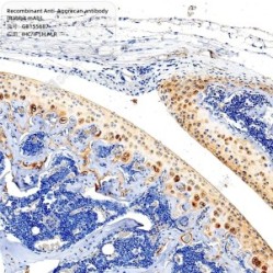 Recombinant Anti-Aggrecan antibody (Rabbit mAb) - 100 µL