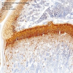 Recombinant Anti-Aggrecan antibody (Rabbit mAb) - 100 µL