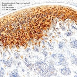 Recombinant Anti-Aggrecan antibody (Rabbit mAb) - 100 µL
