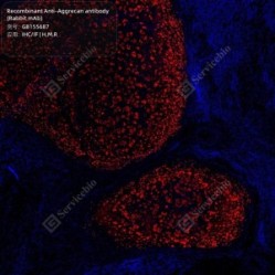 Recombinant Anti-Aggrecan antibody (Rabbit mAb) - 100 µL