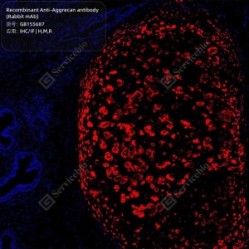 Recombinant Anti-Aggrecan antibody (Rabbit mAb) - 100 µL