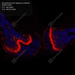 Recombinant Anti-Aggrecan antibody (Rabbit mAb) - 100 µL
