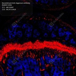 Recombinant Anti-Aggrecan antibody (Rabbit mAb) - 100 µL