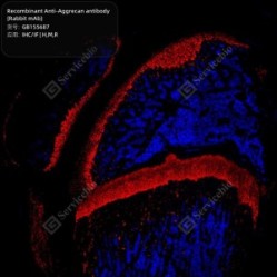 Recombinant Anti-Aggrecan antibody (Rabbit mAb) - 100 µL