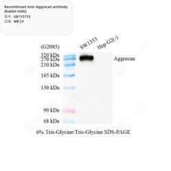 Recombinant Anti-Aggrecan antibody (Rabbit mAb) - 100 µL