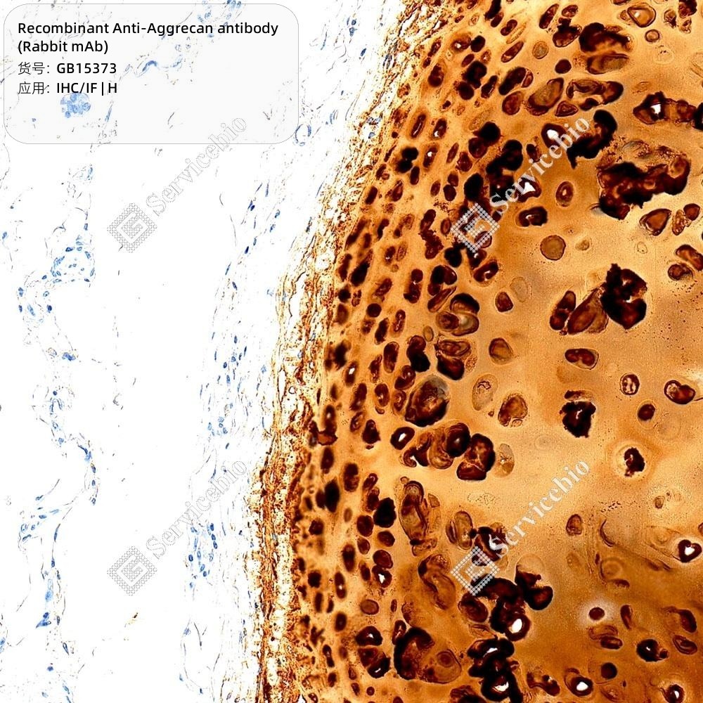 Recombinant Anti-Aggrecan antibody (Rabbit mAb) - 50 µL