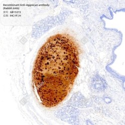 Recombinant Anti-Aggrecan antibody (Rabbit mAb) - 100 µL