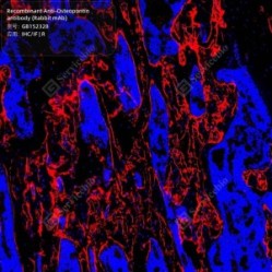 Recombinant Anti-Osteopontin antibody (Rabbit mAb) - 50 µL