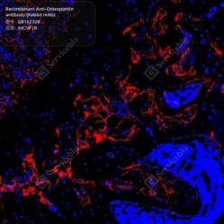 Recombinant Anti-Osteopontin antibody (Rabbit mAb) - 50 µL