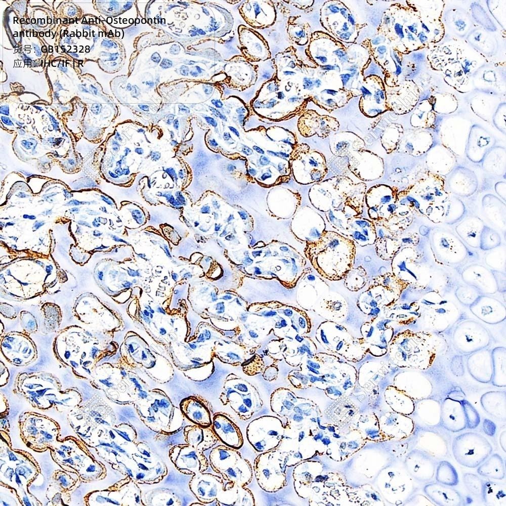Recombinant Anti-Osteopontin antibody (Rabbit mAb) - 100 µL