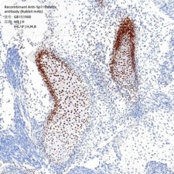 Recombinant Anti-Sp7/Osterix antibody (Rabbit mAb) - 50 µL