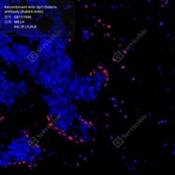 Recombinant Anti-Sp7/Osterix antibody (Rabbit mAb) - 50 µL
