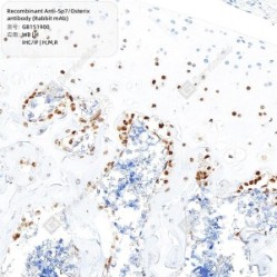 Recombinant Anti-Sp7/Osterix antibody (Rabbit mAb) - 100 µL