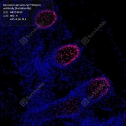 Recombinant Anti-Sp7/Osterix antibody (Rabbit mAb) - 100 µL