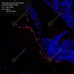 Recombinant Anti-Sp7/Osterix antibody (Rabbit mAb) - 100 µL