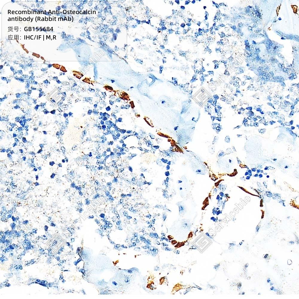 Recombinant Anti-Osteocalcin antibody (Rabbit mAb) - 50 µL