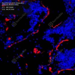 Recombinant Anti-Osteocalcin antibody (Rabbit mAb) - 50 µL