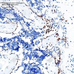 Recombinant Anti-Osteocalcin antibody (Rabbit mAb) - 100 µL