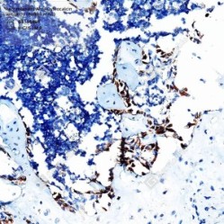 Recombinant Anti-Osteocalcin antibody (Rabbit mAb) - 100 µL