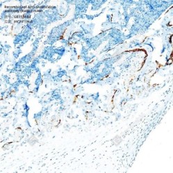 Recombinant Anti-Osteocalcin antibody (Rabbit mAb) - 100 µL