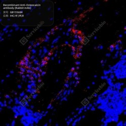 Recombinant Anti-Osteocalcin antibody (Rabbit mAb) - 100 µL