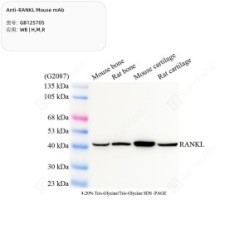 Anti-RANKL Mouse mAb - 50 µL