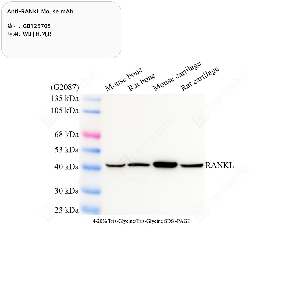 Anti-RANKL Mouse mAb - 50 µL