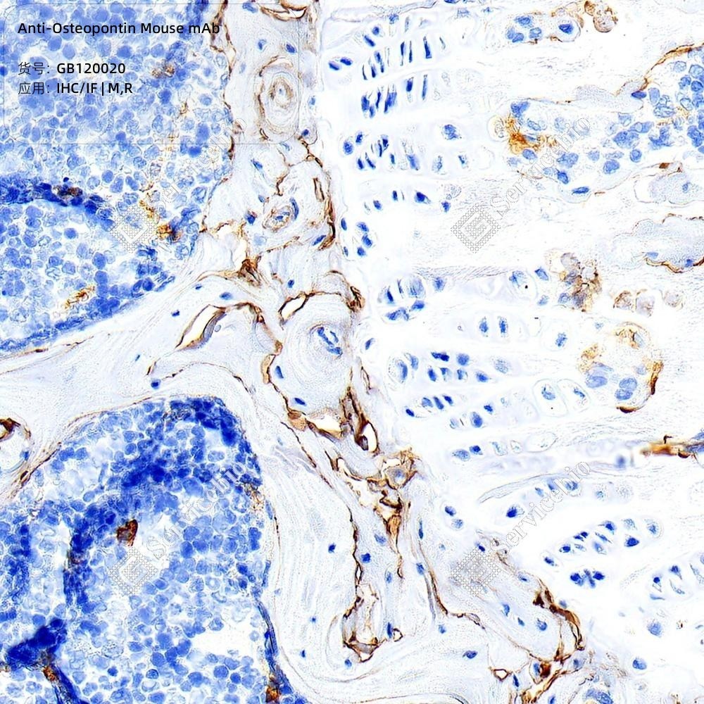 Anti-Osteopontin Mouse mAb - 50 µL