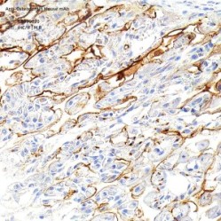 Anti-Osteopontin Mouse mAb - 50 µL
