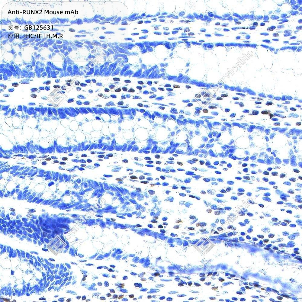 Anti-RUNX2 Mouse mAb - 50 µL