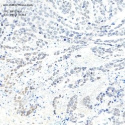 Anti-RUNX2 Mouse mAb - 100 µL