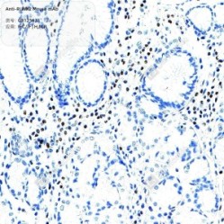Anti-RUNX2 Mouse mAb - 100 µL