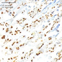 Anti-RUNX2 Mouse mAb - 100 µL