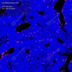 Anti-RUNX2 Mouse mAb - 100 µL