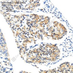 Recombinant Anti-BMP2 antibody (Rabbit mAb) - 50 µL