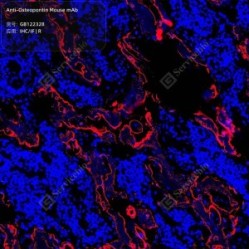 Anti-Osteopontin Mouse mAb - 50 µL