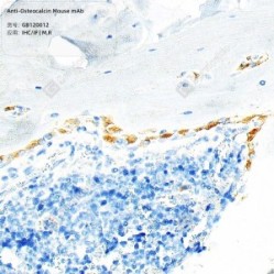 Anti-Osteocalcin Mouse mAb - 50 µL