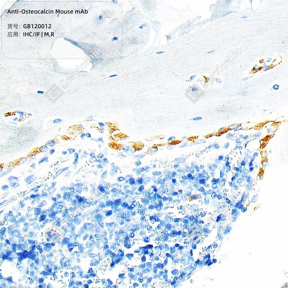 Anti-Osteocalcin Mouse mAb - 50 µL