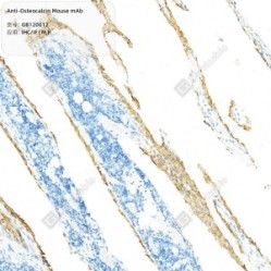 Anti-Osteocalcin Mouse mAb - 50 µL