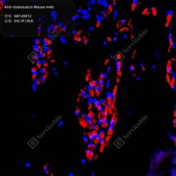 Anti-Osteocalcin Mouse mAb - 50 µL