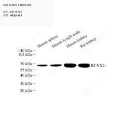Anti-RUNX2 Rabbit pAb - 50 µL