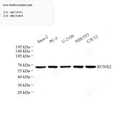 Anti-RUNX2 Rabbit pAb - 100 µL