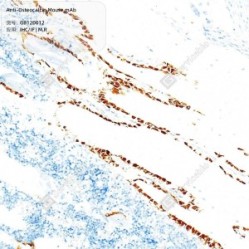 Anti-Osteocalcin Mouse mAb - 100 µL