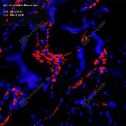 Anti-Osteocalcin Mouse mAb - 100 µL