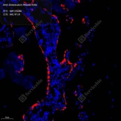 Anti-Osteocalcin Mouse mAb - 50 µL