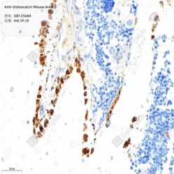 Anti-Osteocalcin Mouse mAb - 100 µL
